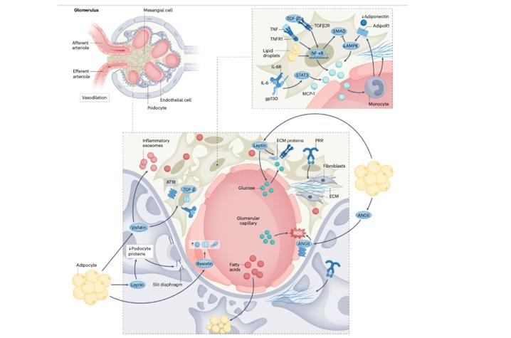 This is a photo that shows anatomical and functional effects of obesity on the glomerulus. Figure provided by Analia Loria Kinsey and lab.