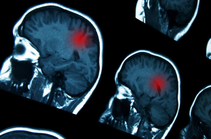 This is a photo of a brain scan, iStock/Getty Images Plus.