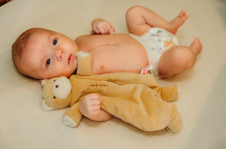 Reid Damron of Grayson was born with dextro-transposition of the great arteries, a rare congenital heart defect in which the aorta and pulmonary aorta are switched. Photo provided by the Damron family.