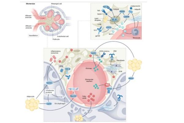 This is a photo that shows anatomical and functional effects of obesity on the glomerulus. Figure provided by Analia Loria Kinsey and lab.