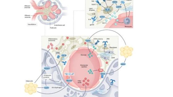 This is a photo that shows anatomical and functional effects of obesity on the glomerulus. Figure provided by Analia Loria Kinsey and lab.