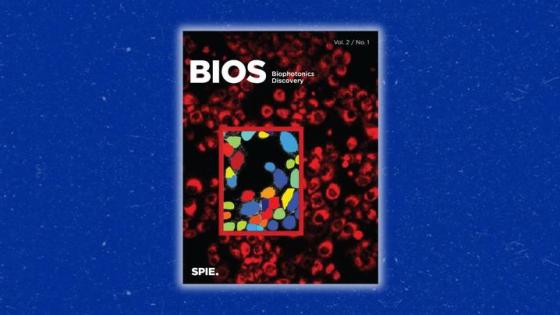 This is a photo of the cover of the Biophotonics Discovery, which includes a study led by Caigang Zhu. Photo credit: Caigang Zhu.