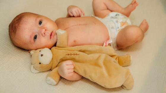Reid Damron of Grayson was born with dextro-transposition of the great arteries, a rare congenital heart defect in which the aorta and pulmonary aorta are switched. Photo provided by the Damron family.